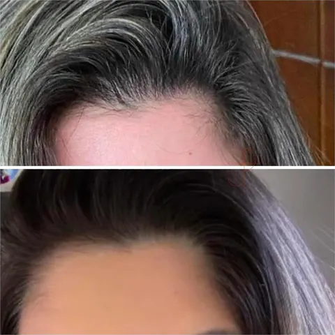 Antes e depois de uma cliente da Consulta de Tricologia Integrativa